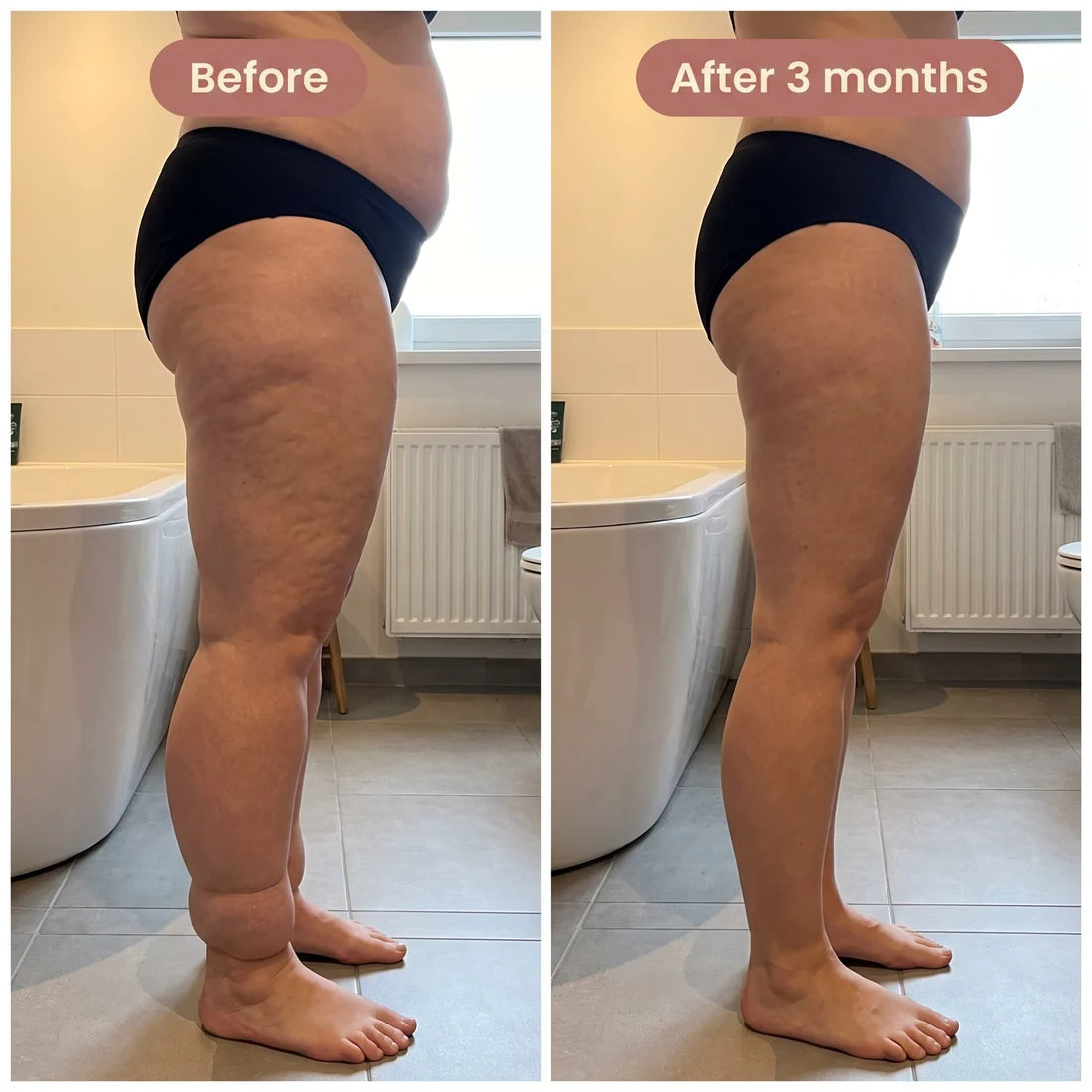 Sira Sculpt 4D Lipedema Leggings